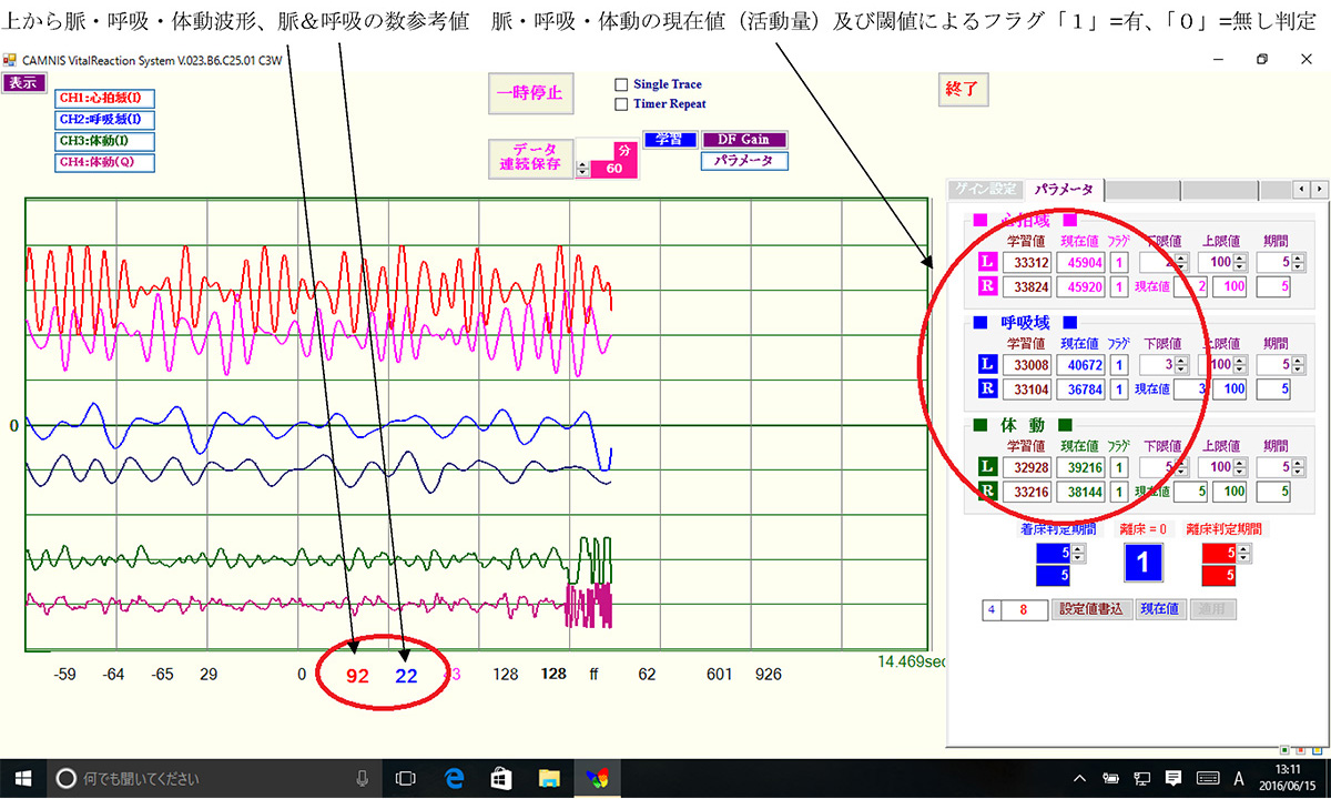 脈・呼吸・体動波形